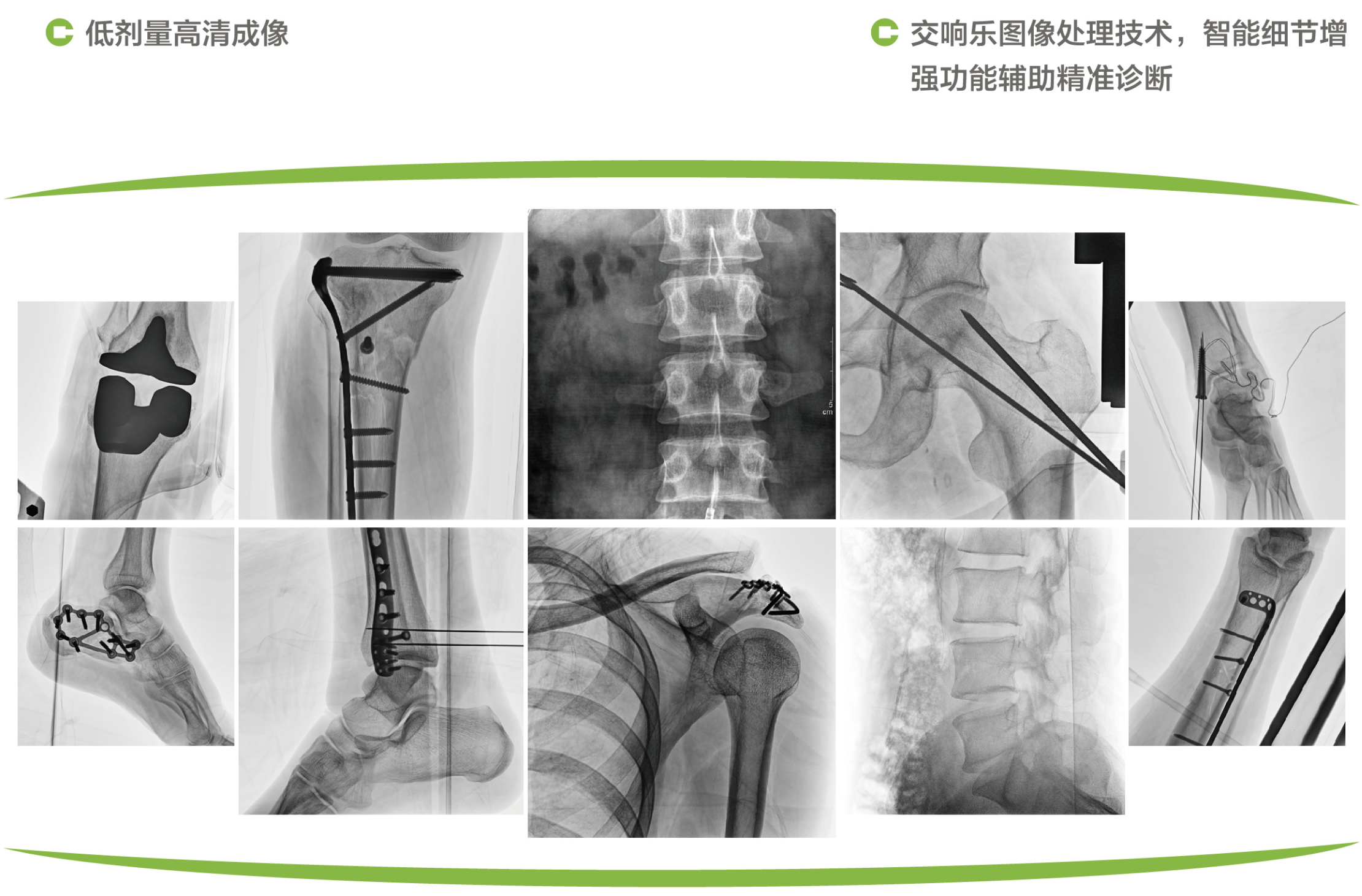 6移動(dòng)式C形臂X射線機(jī)5.png
